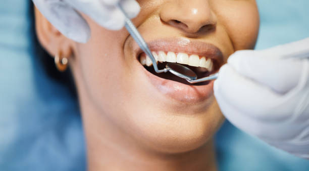 Best Emergency Broken Tooth Repair in Ranger, TX